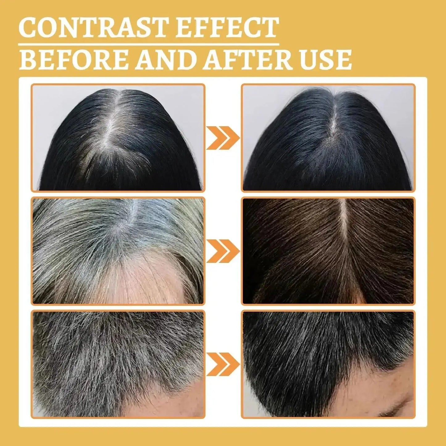 Anti Gray White Hair Serum Liquid White To Black Natural Color Repair Nourish Scalp Products Anti Loss Hairs Care For Men Women