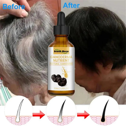 Anti Gray White Hair Serum Liquid White To Black Natural Color Repair Nourish Scalp Products Anti Loss Hairs Care For Men Women