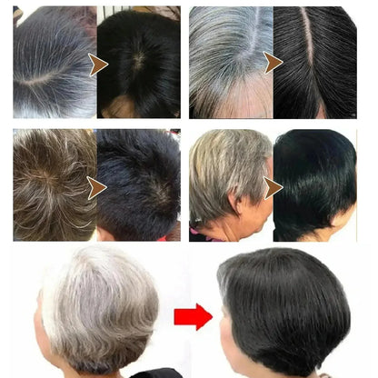 Anti Gray White Hair Serum Liquid White To Black Natural Color Repair Nourish Scalp Products Anti Loss Hairs Care For Men Women