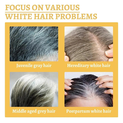 Anti Gray White Hair Serum Liquid White To Black Natural Color Repair Nourish Scalp Products Anti Loss Hairs Care For Men Women