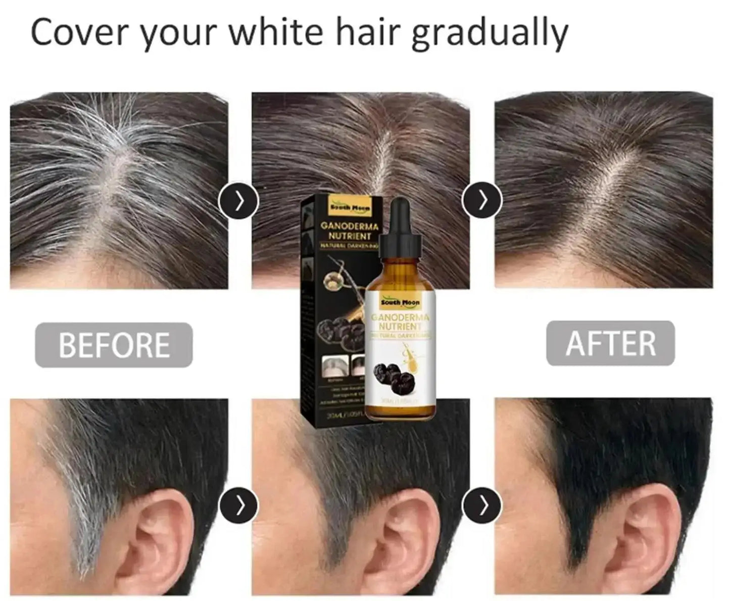 Anti Gray White Hair Serum Liquid White To Black Natural Color Repair Nourish Scalp Products Anti Loss Hairs Care For Men Women