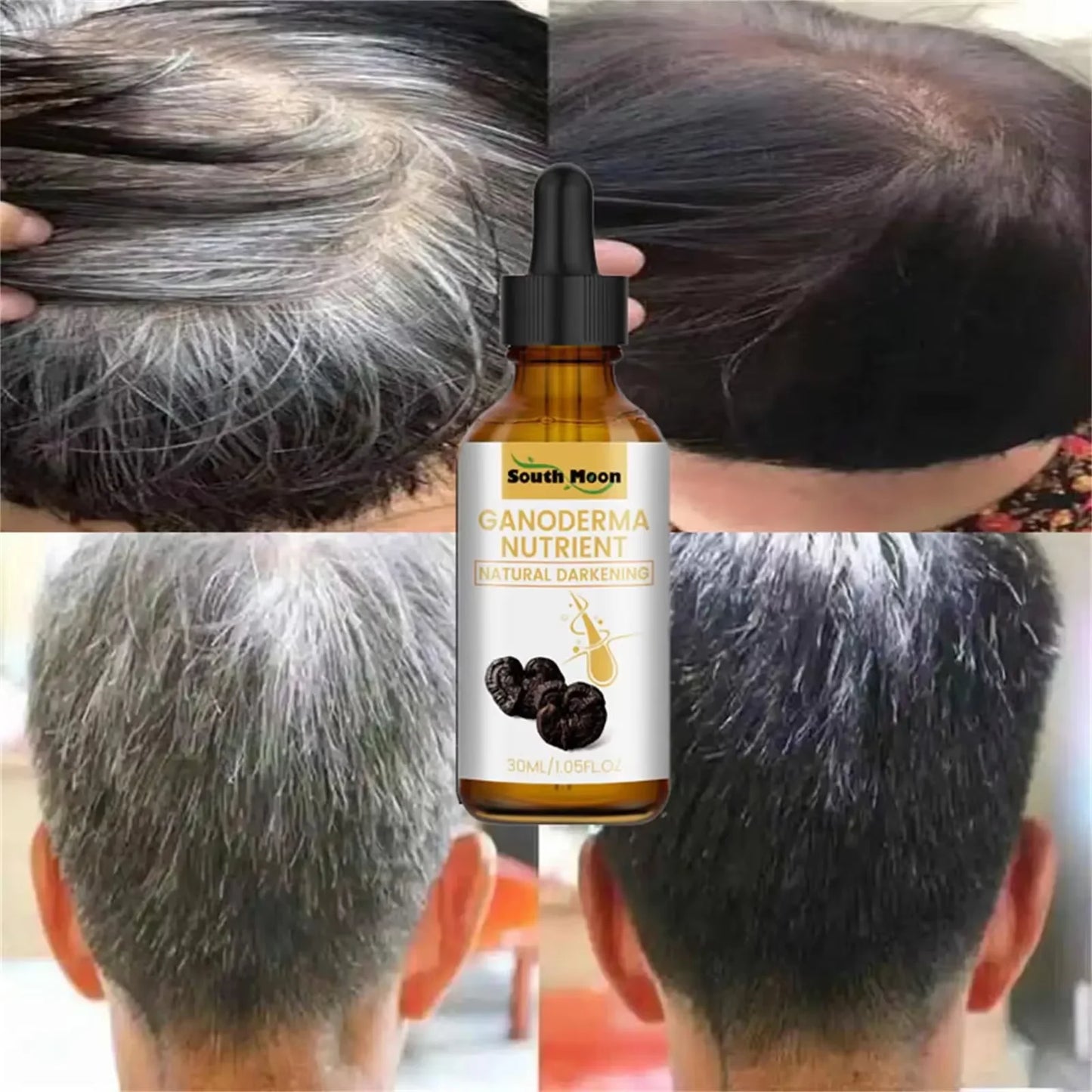 Anti Gray White Hair Serum Liquid White To Black Natural Color Repair Nourish Scalp Products Anti Loss Hairs Care For Men Women